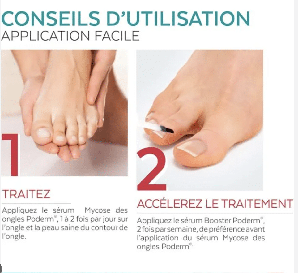 PODERM SÉRUM MYCOSE DES ONGLES – Image 2